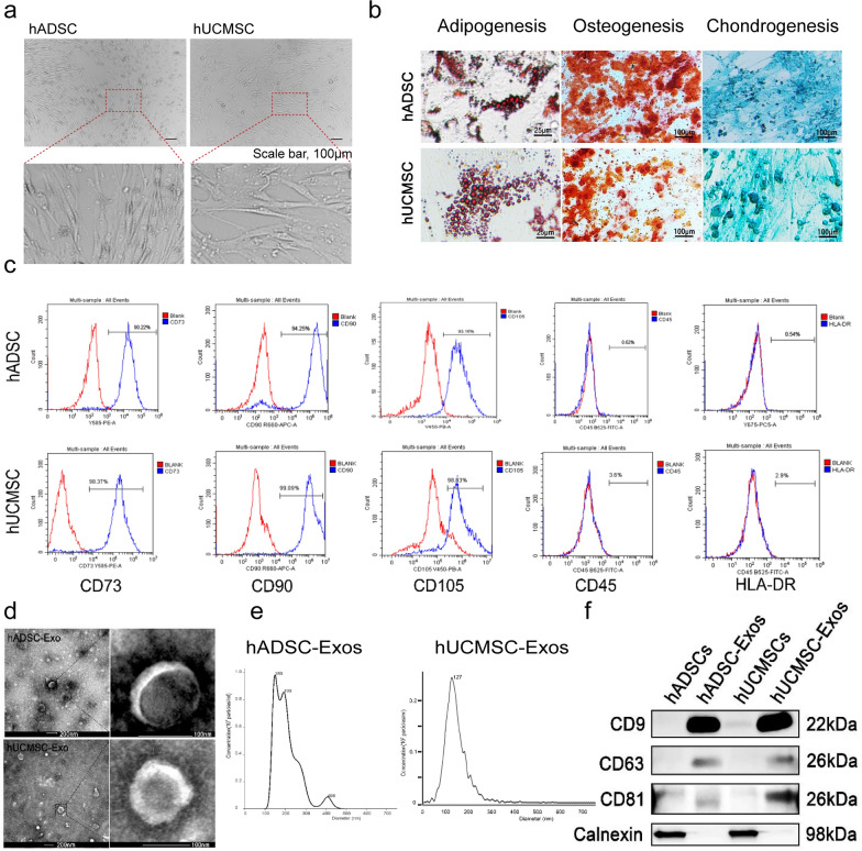 Fig. 1. Identification of the exosome from hADSC and hUCMSC. a Morphology of hADSC and hUCMSC. Scale bar = 100 μm. b Multiple differentiation potential of hADSC and hUCMSC. Scale bar = 25 or 100 μm. c Surface markers profiling of hADSC and hUCMSC. The cells were highly positive for CD105, CD90, and CD73 and were negative for HLA-DR and CD45. d By TEM, purified hADSC-Exo and hUCMSC-Exo exhibit cup-like morphologies. e Nanoparticle analysis of hADSC-Exo and hUCMSC-Exo. f The protein markers in hADSC, hUCMSC, and their exosomes were analyzed by Western blot. hADSC-Exo and hUCMSC-Exo can express their common positive markers CD81, CD63, and CD9, however, the negative marker Calnexin is not expressed. WB analysis of whole cell lysates of the hADSCs and hUCMSCs shown in f