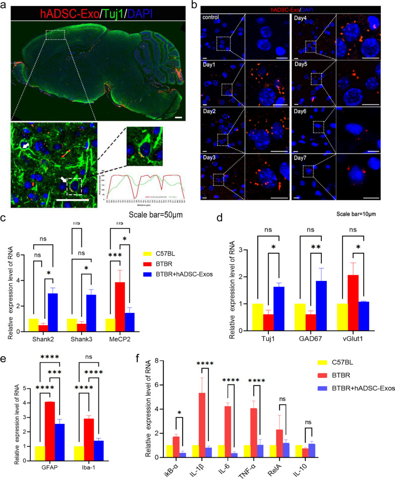Fig. 4. The hADSC-Exo treatment demonstrates the ability to modulate the expression of genes associated with neurogenesis and brain inflammation in BTBR mice. a Mouse brain localization injection of hADSC-Exos. PKH26-labeled hADSC-Exos co-localized with Tuj1 + neurons. b PKH26-labelled hADSC-Exos was localized and injected, and tissues were collected from day 1 to day 7 for immunofluorescence staining. c–f qRT-PCR. c ASD marker gene expression examined by qRT-PCR. d Neuron genes expression confirmed by qRT-PCR. e Astrocyte and microglia activation genes expression detected by qRT-PCR. f Inflammatory genes expression analyzed by qRT-PCR. All data were analyzed by two-way ANOVA followed by Tukeys multiple comparison test. Statistical differences were analyzed by two-way ANOVA followed by Tukeys multiple comparison test. Bars represent mean and error bars S.E.M. *p < 0.05, **p < 0.01, ***p < 0.001