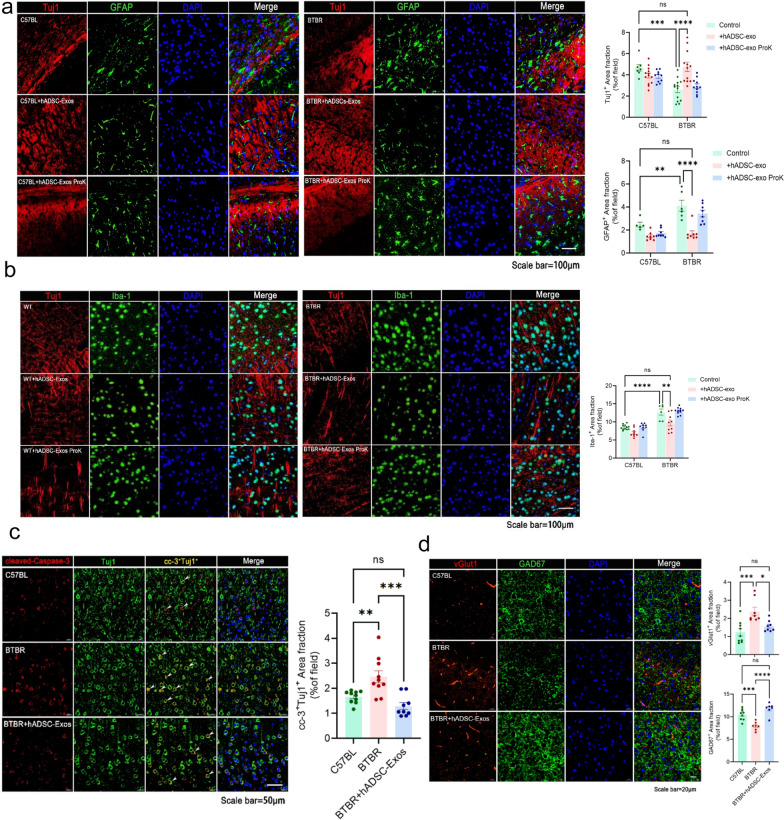 Fig. 5. BTBR mice brains treated with hADSC-Exos showed reduced inflammation and increased neurogenesis in the PFC region. a–d Immunofluorescence double-staining of formalin-fixed mice brain sections. a Staining for committed neuronal markers GFAP (green immunofluorescence) and Tuj1 staining (red immunofluorescence) in the PFC is shown, and DAPI staining (blue fluorescence). b Iba-1 fluorescence in green and Tuj1 immunofluorescence in red (Texas Red), and DAPI staining (blue fluorescence). c Representative immunofluorescence images reveal Tuj1 (green) and CC-3 (red) immunoreactive (Tuj1 + /CC-3+) cells in the PFC region. d The red color is vGlut1 staining and the green color is GAD67, and nuclear staining by DAPI staining (blue fluorescence). A two-way ANOVA followed by Tukeys multiple comparison test was applied to all data. Error bars represent S.E.M. *p < 0.05, **p < 0.01, ***p < 0.001