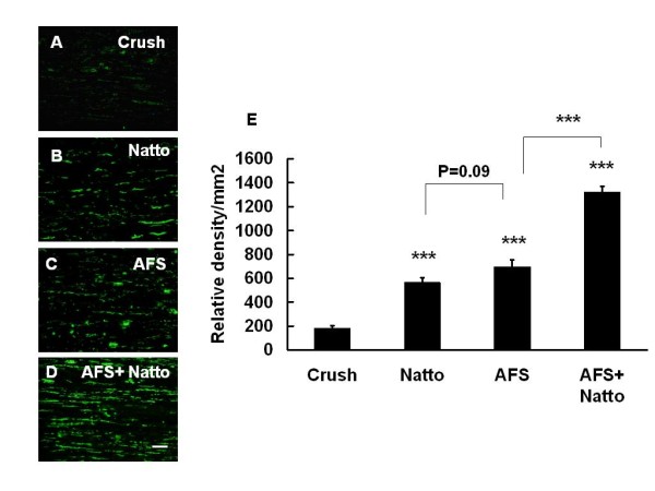 Figure 3. Determination of neurofilament. The nerve tissues were retrieved 7 days after injury and were subjected to IHC with antibody against neurofilament in the four treatment groups: (A) Crush, (B) Natto, (C) AFS, and (D) AFS+ Natto. The quantitative analysis of relative density of neurofilament is depicted in (E). P values in the Natto, AFS, and Natto+ AFS groups were determined relative to the crush group. *** p < 0.001; n = 6; bar length = 50 μm.