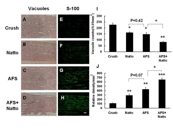 Figure 4. Representative illustration of vacuole counts and S-100. The left sciatic nerve was crushed, and the four different treatments were applied. After 4 weeks, the injured nerves were retrieved and were subjected to histological assay and antibody against S-100 for determination of vacuole counts (A-D) and myelination (E-F). Quantitative analysis is depicted in (I, J). * p < 0.05, ** p < 0.01, *** p < 0.001, n = 6, bar length = 50 μm.