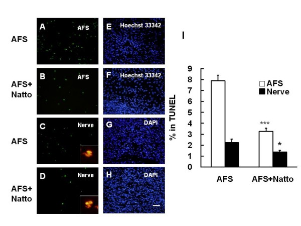 Figure 5. Determination of apoptosis. The nerve tissues implanted with AFS and treated with or without Natto were obtained 7 days after injury and subjected to apoptotic assay by TUNEL in the AFS (A-B) and crushed nerve (C-D) groups. (E, F) Hoechst 33342 staining in AFS corresponded to the areas in (A) and (B). (G, H) DAPI staining in the injured nerve corresponded to areas in (C) and (D). Magnification box indicated the merged imaging of TUNEL with S-100 (red). The quantitative analysis of TUNEL in the AFS and injured nerve groups is shown in (I). * p < 0.05, *** p < 0.001, bar length = 50 μm, n = 6.