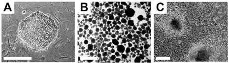 Figure 2.. Typical undifferentiated and differentiating hESCs in culture.(A) A compact colony of proliferating pluripotent hESCs can be seen when cultured in defined medium on mouse embryonic fibroblasts. (B) Floating hEBs observed at 3 days after induction of differentiation. (C) Differentiating tissues, including cardiomyocytes, appear within adherent cultures at 48 hours after plating hEBs onto a gelatin-coated culture dish. Bar, 25 μm.