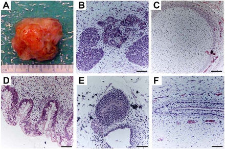 Figure 3.. Teratoma formation provides an in vivo assay of hESCs differentiation capacity.Proliferating cultures of hESCs were used to form teratomas by renal capsule grafting using established methods. (A) An explanted teratoma is shown. (B-F) Teratomas were sectioned and stained with hematoxylin and eosin to identify embryonic tissues. Representative tissues from all three embryonic germ layers can be seen, including mesoderm (B,C), endoderm (D) and ectoderm (E,F). (B) Nascent renal tubules and glomeruli within bed of primitive renal epithelium. (C) Cartilage surrounded by capsule of condensed mesenchyme. (D) Glandular intestinal structure. (E) Nascent neural tube. (F) Primitive squamous epithelium. Bar, 100 μm.