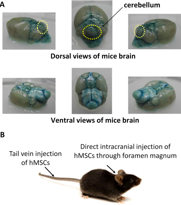 Figure 1. Route of human mesenchymal stem cells transplantation and gross pictures of mice brain after trypan blue injection. (A) 100 μL trypan blue was injected through foramen magnum into position of cerebellum in a wild-type mouse, which was immediately sacrificed for visual examination to determine target accuracy. Most of the areas staining by trypan blue were located at cerebellum, medulla and nearby regions. (B) hMSCs were injected intravenously via tail vein or intracranially through foramen magnum under anesthesia. hMSCs, human mesenchymal stem cells.
