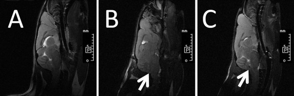 Figure 2. Magnetic resonance images of mice after superparamagnectic iron oxide nanoparticles (SPIO)-labeled and unlabeled human mesenchymal stem cells transplantation. Mice were anesthetized, followed by injection of 8.4 × 106 per kg of mice body weight unlabeled hMSCs (A, wild-type mouse) or SPIO-labeled hMSCs (B, wide-type mouse; C, SCA2 transgenic mouse) in PBS through foramen magnum intracranially, and then measured in a 7-T MR imager 24 h later. (A) No signal was detected in the medulla or cerebellum of wild-type mouse after intracranial transplantation of unlabeled hMSCs. (B) A significant decreased T2 signal intensity of the SPIO (white arrow) was detected in the dorsal site of medulla of wild-type mouse after intracranial transplantation of SPIO-labeled hMSCs. (C) A significant decreased T2 signal intensity of the SPIO (white arrow) was detected in the dorsal site of medulla of transgenic mouse after intracranial transplantation of SPIO-labeled hMSCs. The length of each small scale was 1 mm. The letter "P" indicated posterior direction.