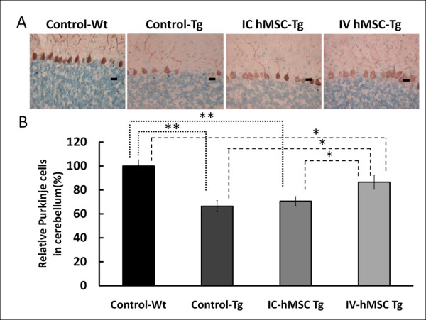 Figure 5. Immunohistochemistry staining for murine Purkinje cells in cerebellum. (A) Whole brain sections of wild-type mouse, SCA2 Tg mouse as control, and SCA2 transgenic mouse which received intravenous and intracranial human mesenchymal stem cells transplantation (4 μm) were processed by immunohistochemistry of calbindin D28K for Purkinje cells. Photographs were taken from the view of 100-folds microscopy and the scale bar was 40 μm. (B) Quantitative counting of calbindin D28K+ cells in cerebellum were compared to those of Control-Wt. Statistical analysis was performed by one-way ANOVA. (* p < 0.05; ** p < 0.001).