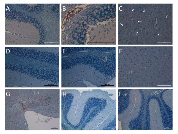 Figure 6. Immunohistochemistry staining for human mesenchymal stem cells in whole brain sections of mice. Whole brain sections of each mice (4 μm) were proceeded immunohistochemistry staining of β2 microglobulin for hMSCs. Photographs were taken from the view of 100, 200 or 400-folds microscopy and the scale bar was 100 μm. (A-C) In IV-hMSC-Tg group, hMSCs were located over the cerebellar white matter (A), molecular layer, and the lumens of blood vessels in white matter (B). Large clusters of grafted hMSCs were detected within cerebral cortex as arrows (C). (D-G) In IC-hMSC-Tg group, positive brown signals were not detected over cerebellar white matter, molecular layer, or the Purkinje cell layer (D), but limited to a few lumen of blood vessels (E) and a few scattered cells in cerebral cortex (F). Positive signals of hMSCs were detected over the injection site beneath the dorsal surface of medulla (G), which was adjacent to the cerebellum. (H, I) No signals were detected in the cerebellar sections of Control-Wt (H) and Control-Tg mice (I).