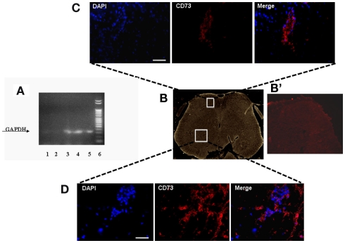Figure 2. (A) Representative agarose gel blot analysis for human GAPDH gene of 30 days-SNI/hMSCs mice following RT-PCR is shown. Lane (1) lung; lane (2) sciatic nerve; lane (3) ventral L4–L5 spinal cord and (4) dorsal L4–L5 spinal cord; lane (5) pre-frontal cortex; lane (6) DNA ladder marker. The analysis of mRNA levels was carried out by the “Gel Doc 2000 UV System” (Bio-Rad, Hercules, CA, USA). RT-PCR analysis revealed a preferential accumulation of hMSCs to the L4–L5 spinal cord (both ventral and dorsal areas) and pre-frontal cortex. Very weak band was found from lung. No GAPDH band was detectable in sciatic nerve, thus revealing the specificity of hMSC engraftment at the NP controlling and processing areas. (B) Representative cross-section of mouse whole L4–L5 spinal cord area from hMSC-treated 30 days-neuropathic mice (26 days post-hMSC injection). (B’) Representative cross-section of mouse whole L4–L5 spinal cord area from vehicle treated 30 days-neuropathic mice showing no staining for human specific CD73. (C,D) Human MSCs expressed lineage-specific antigens at 26 days post-injection in vivo. Representative fluorescent photomicrograph of hMSCs showing immunocytochemistry for CD73. Area in white rectangle insets is shown: (C) ventral spinal cord; (D) dorsal spinal cord; left: cell nuclei were counterstained with DAPI (blue fluorescence); middle: CD73-positive hMSCs emitted red fluorescence; right: pictures with both red and blue fluorescence were merged. Scale bars: 100 μm.
