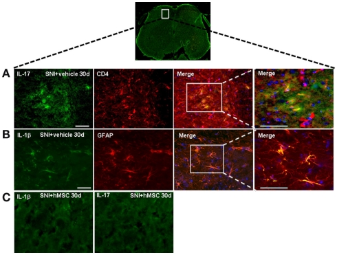 Figure 4. Representative cross-section of mouse L4–L5 spinal cord from 30 days-neuropathic mice. (A) First: IL-17 positive profiles (green fluorescent) in vehicle treated 30 days-neuropathic mice (SNI + vehicle). Second: CD4 positive profiles (red fluorescent) in vehicle treated 30 days-neuropathic mice. Third: double labeling of IL-17 and CD4 positive profiles. Fourth: higher magnification showing that the cells expressing IL-17 were T lymphocytes. Cell nuclei were counterstained with DAPI (blue fluorescence). Scale bars: 100 μm. (B) First: IL-1β positive profiles (green fluorescent) in vehicle treated 30 days-neuropathic mice. Second: GFAP positive profiles (red fluorescent) in vehicle treated 30 days-neuropathic mice. Third: double labeling of GFAP and IL-1β positive profiles. Fourth: higher magnification indicating that the cells expressing IL-1β were astrocytes. Cell nuclei were counterstained with DAPI (blue fluorescence). Scale bars: 100 μm. (C) First: IL-1β profiles (green fluorescent) in hMSC-treated 30 days-neuropathic mice (SNI + hMSCs). Second: IL-17 profiles (green fluorescent) in hMSC-treated 30 days-neuropathic mice (SNI + hMSCs). The absence of positive staining indicates that injected hMSCs were able to reduced the protein levels of pro-inflammatory interleukins IL-1β and IL-17, confirming western blot analysis results.