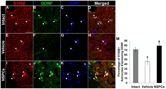 Figure 10. Effect of human NSPC grafting on the expression of GDNF in host hippocampal astrocytes.GDNF expression in S100β+ hippocampal astrocyte was observed in an age-matched intact control (A–D), vehicle-injected pilocarpine-treated (E–H), and NSPC-transplanted pilocarpine-treated rats (I–L). Nuclei were counterstained with DAPI (C, G, and K). Arrowheads in A–L indicated S100β/GDNF double-labeled cells. Arrows in E, G and H denoted S100β+ host hippocampal astrocytes that were devoid of GDNF immunoreactivity in vehicle-injected epileptic rats. Scale bar, 50 µm. (M) The bar chart represents percentages of S100β+ astrocytes expressing GDNF in the CA3 region of the hippocampus in the three groups. There was a significant difference between intact controls and vehicle-injected epileptic rats (P = 0.022) and between vehicle-injected and NSPC-transplanted epileptic rats (P = 0.038). * Significantly different from the age-matched intact control group at P<0.05; † significantly different from vehicle-injected group at P<0.05; error bars indicate ±SEM.