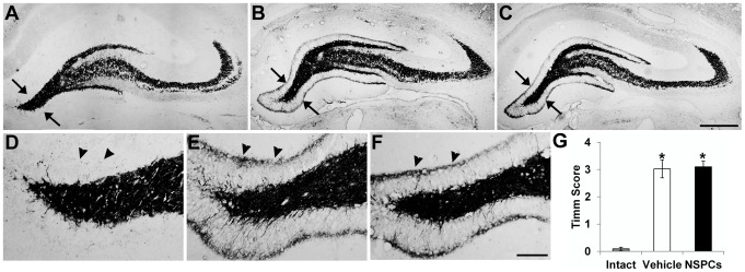 Figure 11. Effect of human NSPC grafting on aberrant mossy fiber sprouting in pilocarpine-treated animals.(A–F) Timm staining exhibits mossy fiber staining from age-matched intact control (A, D), vehicle-injected pilocarpine-treated (B, E) and huNSPCs-transplanted pilocarpine-treated rats (C, F) 3 months following transplantation. D–F are high-magnification views of areas indicated by arrows in A–C, respectively. Arrowheads in D–F indicate the supragranular region of the dentate gyrus. Pilocarpine-treated rats reveal mossy fiber sprouting with an increased density of Timm granules in the supragranular region (B, C, E, F), whereas control rats did not (A, D). Scale bar, 500 µm (C), 100 µm (F). (G) NSPC-transplanted and vehicle injected rats had higher Timm scores than the control group (*P<0.05). Error bars, SEM. No significant difference regarding Timm score was found between NSPC- and vehicle-injected groups.