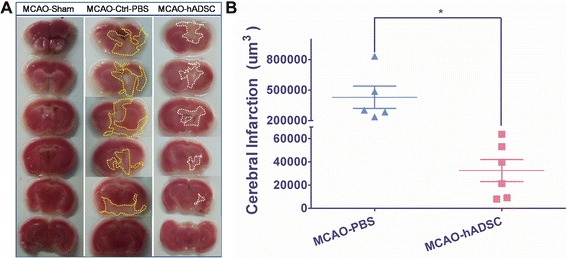 Figure 4. Brain infarction volume determined by TTC staining. Representative TTC staining pictures of mouse brain within each group (A), and the statistical analysis by Scion Image Software (B). * means significant differences were found between groups (P <0.05). TTC, 2,3,5-triphenyltetrazolium chloride.
