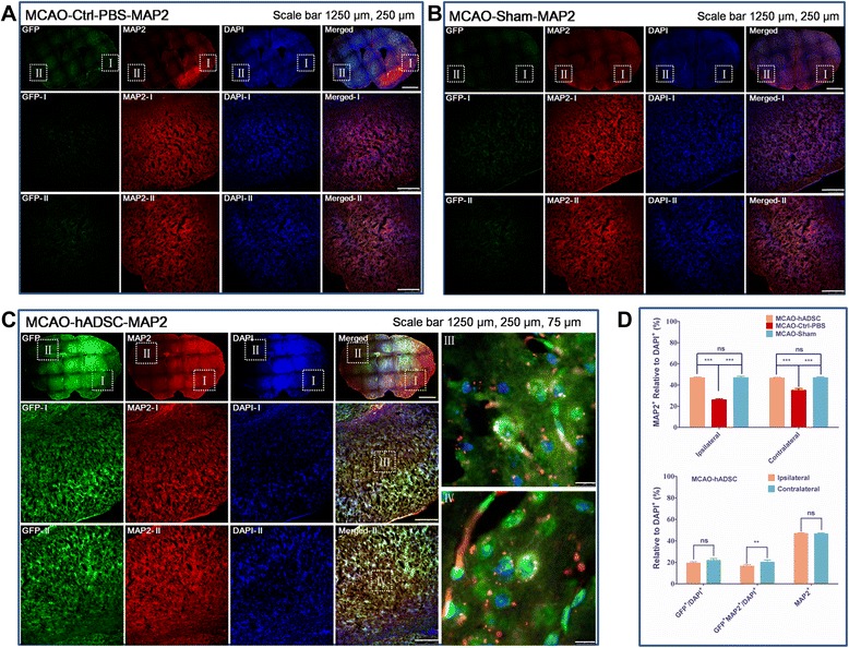 Figure 5. hADSC tracing by histoimmunostaining with MAP2 antibody. MCAO mouse group with PBS injection instead of hADSC serving as the negative control (MCAO-Ctrl-PBS) (A), normal mice with blood vessel exposure only but not occlusion (MCAO-Sham) (B), MCAO mouse group with hADSC injection seven days after MCAO surgery (MCAO-hADSC) (C). Quantitative analysis of GFP labeled hADSCs, MAP2+ relative to the DAPI+ means neurons relative to the total cells in both the ipsilateral and contralateral areas of different groups of the MCAO brain, GFP relative to the DAPI+ means the survival hADSCs take the ratio of total brain cells, GFP+/MAP2+ relative to DAPI+ means the injected hADSCs which differentiated into MAP2+ cells take the ratio of total brain cells (D). *, ** and *** indicates that significant differences were found between groups (P<0.05, P<0.01 and P<0.001, respectively). DAPI, 4',6-diamidino-2-phenylindole; hADSC, human adipose-derived stem cells; MAP2, microtubule-associated protein 2; MCAO, middle cerebral artery occlusion.