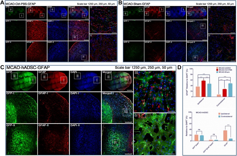 Figure 6. hADSC tracing by histoimmunostaining with GFAP antibody. MCAO mouse group with PBS injection instead of hADSC serving as the negative control (MCAO-Ctrl-PBS) (A), normal mice with blood vessel exposure only but not occlusion (MCAO-Sham) (B), MCAO mouse group with hADSC injection seven days after MCAO surgery (MCAO-hADSC) (C). Quantitative analysis of GFP labeled hADSCs, GFAP+ relative to the DAPI+ means astrocytes cells take the ratio of total cells in both the Ipsilateral and Contralateral of different groups of the MCAO brain, GFP relative to the DAPI+ means the survival hADSCs take the ratio of total brain cells, GFP + /GFAP + relative to DAPI + means the hADSCs transdifferentiated into astrocytes take the ratio of total brain cells (D). *, ** and *** indicates that significant differences were found between groups (P<0.05, P<0.01 and P<0.001, respectively). DAPI, 4',6-diamidino-2-phenylindole; GFAP, glial fibrillary acidic protein; hADSC, human adipose-derived stem cells; MCAO, middle cerebral artery occlusion.